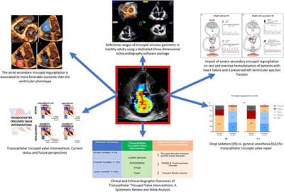 Editorial: Open issues in the diagnosis and management of tricuspid regurgitation